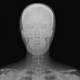 RSD ART-200XCB Male ART Phantom with Cadaver Bones, Undrilled - Clinical Image of Head Section