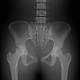 RSD ART-200XCB Male ART Phantom with Cadaver Bones, Undrilled - Clinical Image of Lower Body Section