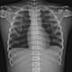 RSD Male ART Phantom with Cadaver Bones - Clinical Image of Upper Body Section