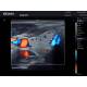 Edan AX3-MAINUNIT Acclarix AX3 Color Compact Ultrasound System - Clinical Image 2