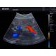 Edan AX3-MAINUNIT Acclarix AX3 Color Compact Ultrasound System - Clinical Image 3