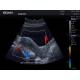 Edan AX3-MAINUNIT Acclarix AX3 Color Compact Ultrasound System - Clinical Image 4