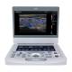 Edan AX3-MAINUNIT Acclarix AX3 Color Compact Ultrasound System