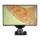 LW Scientific BVP-SCRN-1163 13.3" HD Camera Monitor - Sample Image on Screen (Microscope is Sold Separately)