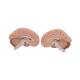 3B Scientific C05 Head and Neck Musculature 5-Part - 3B Smart Anatomy
