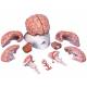 Deluxe Brain with Arteries Model 9-Part