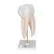 Upper Triple-Root Molar 3-Part - 3B Smart Anatomy