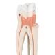 Upper Triple-Root Molar 3-Part - 3B Smart Anatomy