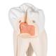 Upper Triple-Root Molar 3-Part - 3B Smart Anatomy