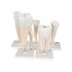 3B Scientific D10 Classic Tooth Model Series (5 Models) - 3B Smart Anatomy
