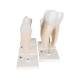 3B Scientific D10 Classic Tooth Model Series (5 Models) - 3B Smart Anatomy