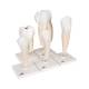 3B Scientific D10 Classic Tooth Model Series (5 Models) - 3B Smart Anatomy