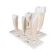 3B Scientific D10 Classic Tooth Model Series (5 Models) - 3B Smart Anatomy
