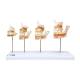 3B Scientific D20 Dentition Development - 3B Smart Anatomy