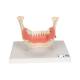 3B Scientific D26 Diseases of the Teeth 21-Part - 3B Smart Anatomy