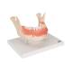 3B Scientific D26 Diseases of the Teeth 21-Part - 3B Smart Anatomy