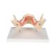 3B Scientific D26 Diseases of the Teeth 21-Part - 3B Smart Anatomy