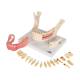 3B Scientific D26 Diseases of the Teeth 21-Part - 3B Smart Anatomy