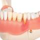 3B Scientific D26 Diseases of the Teeth 21-Part - 3B Smart Anatomy