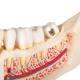 3B Scientific D26 Diseases of the Teeth 21-Part - 3B Smart Anatomy