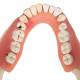 3B Scientific D26 Diseases of the Teeth 21-Part - 3B Smart Anatomy