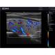 Edan DUS60-MAINUNIT DUS60 Black-and-White Compact Ultrasound System - Clinical Image 2