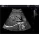 Edan DUS60-MAINUNIT DUS60 Black-and-White Compact Ultrasound System - Clinical Image 4