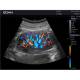 Edan DUS60-MAINUNIT DUS60 Black-and-White Compact Ultrasound System - Clinical Image 5