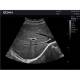 Edan DUS60-MAINUNIT DUS60 Black-and-White Compact Ultrasound System - Clinical Image 6