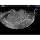 Edan DUS60-MAINUNIT DUS60 Black-and-White Compact Ultrasound System - Clinical Image 7
