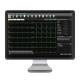 Edan SE-1515 12-Channel PC-Based ECG - Data Transmitted to PC (PC Monitor is Not Included)
