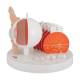 3B Scientific F17 Pathological Eye Model - 3B Smart Anatomy