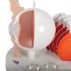 3B Scientific F17 Pathological Eye Model - 3B Smart Anatomy
