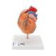 3B Scientific G04 Classic Heart Model with Left Ventricular Hypertrophy (LVH) 2-Part - 3B Smart Anatomy