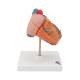 3B Scientific G04 Classic Heart Model with Left Ventricular Hypertrophy (LVH) 2-Part - 3B Smart Anatomy