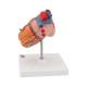 3B Scientific G04 Classic Heart Model with Left Ventricular Hypertrophy (LVH) 2-Part - 3B Smart Anatomy