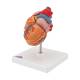 3B Scientific G04 Classic Heart Model with Left Ventricular Hypertrophy (LVH) 2-Part - 3B Smart Anatomy