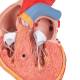 3B Scientific G04 Classic Heart Model with Left Ventricular Hypertrophy (LVH) 2-Part - 3B Smart Anatomy