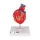3B Scientific G05 Classic Heart Model with Bypass, 2-Part - 3B Smart Anatomy