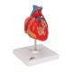 3B Scientific G05 Classic Heart Model with Bypass, 2-Part - 3B Smart Anatomy