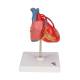 3B Scientific G05 Classic Heart Model with Bypass, 2-Part - 3B Smart Anatomy