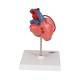3B Scientific G05 Classic Heart Model with Bypass, 2-Part - 3B Smart Anatomy