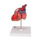3B Scientific G05 Classic Heart Model with Bypass, 2-Part - 3B Smart Anatomy