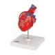 3B Scientific G05 Classic Heart Model with Bypass, 2-Part - 3B Smart Anatomy