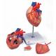 Heart Model with Bypass 2 Times Life-Size 4-Part