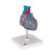 3B Scientific G08-3 Classic Heart Model with Conducting System 2-Part - 3B Smart Anatomy