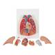 3B Scientific G15 Lung Model with Larynx 7-Part - 3B Smart Anatomy