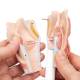 3B Scientific G22 Larynx Model 2-Part - 3B Smart Anatomy