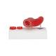 3B Scientific G40 Arteriosclerosis Model with Cross Section of Artery 2-Part - 3B Smart Anatomy