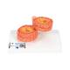3B Scientific G50/1 COPD Bronchial Tissue Model - 3B Smart Anatomy